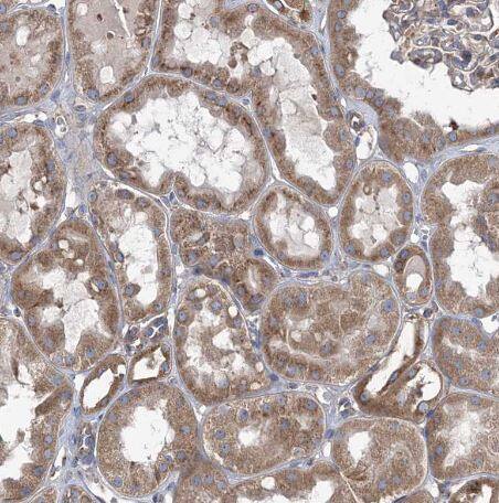 Immunohistochemistry-Paraffin: COPB2 Antibody [NBP1-88651] -Staining of human kidney shows strong cytoplasmic positivity in cells in tubules.