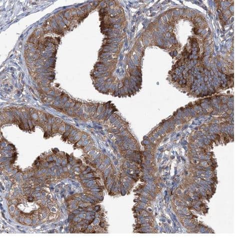 Immunohistochemistry-Paraffin: COPB2 Antibody [NBP1-88651] -Staining of human fallopian tube shows strong cytoplasmic positivity in glandular cells.