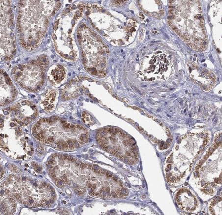 Immunohistochemistry-Paraffin: B4GALT7 Antibody [NBP1-88652] - Staining of human kidney shows moderate granular cytoplasmic positivity in cells in tubules.