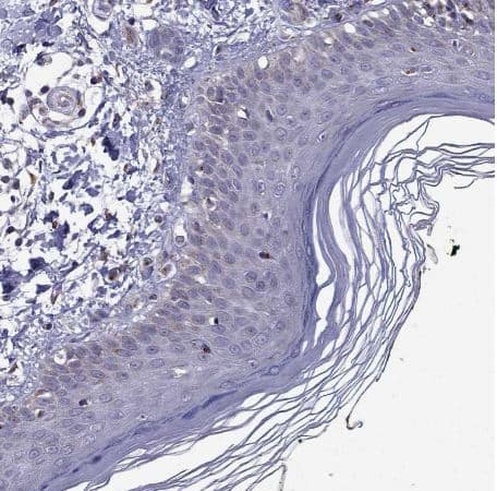 Immunohistochemistry-Paraffin: B4GALT7 Antibody [NBP1-88652] - Staining of human skin shows no positivity in squamous epithelial cells as expected.