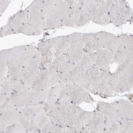  TRAPPC3 Antibody [NBP1-88664]-IHC-P- Staining of human skeletal muscle shows no positivity in myocytes as expected. 