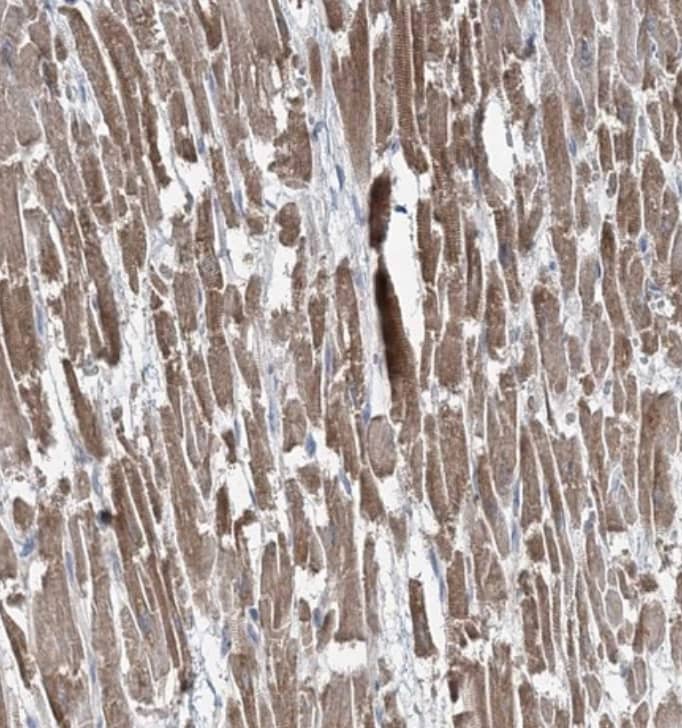 Immunohistochemistry-Paraffin TMLHE Antibody - BSA Free