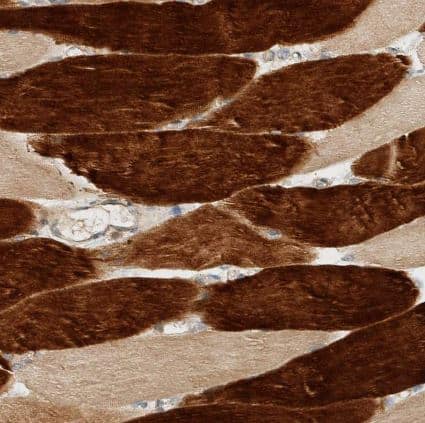 Immunohistochemistry-Paraffin: ARFGEF1 Antibody [NBP1-88840] -Staining of human skeletal muscle shows strong cytoplasmic positivity in myocytes.