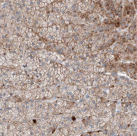 Immunohistochemistry-Paraffin-MRAP Antibody-NBP1-88941-Staining of human adrenal gland shows moderate granular cytoplasmic positivity in glandular cells.