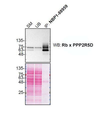 <b>Genetic Strategies Validation. </b>HAP1 lysates were prepared, and immunoprecipitation was performed using 2.0 ug of PPP2R5D antibody (Catalog # NBP1-88959) pre-coupled to Dynabeads protein A. Samples were washed and processed for Western Blot with PPP2R5D antibody. For Western Blot, Rb x PPP2R5D was used at 1/5000. The Ponceau stained transfers of each blot are shown. SM=4% starting material; UB=4% unbound fraction; IP=immunoprecipitate. Image, protocol and testing courtesy of YCharOS Inc. (ycharos.com).