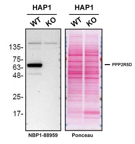Western blot shows lysates of HAP1 human near-haploid cell line and PPP2R5D knockout HAP1 cell line (KO). Nitrocellulose membrane was probed with PPP2R5D Antibody (Catalog # NBP1-88959) O/N at 4C, followed by HRP-conjugated Secondary Antibody and ECL detection. A specific band was detected for PPP2R5D (as indicated) in the parental HAP1 cell line, but is not detectable in knockout HAP1 cell line. The Ponceau stained transfers of each blot are shown. Image, protocol and testing courtesy of YCharOS Inc. (ycharos.com).