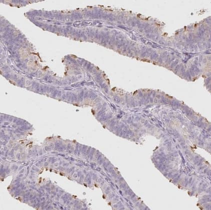 Immunohistochemistry-Paraffin: LRRC23 Antibody [NBP1-88962] -Staining of human fallopian tube shows moderate cytoplasmic positivity in ciliated cells.
