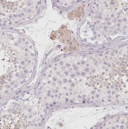 Immunohistochemistry-Paraffin: LRRC23 Antibody [NBP1-88962] -Staining of human testis shows moderate cytoplasmic positivity in Leydig cells.