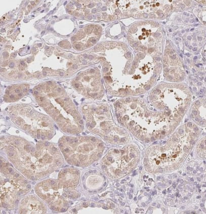 Immunohistochemistry-Paraffin: LRRC23 Antibody [NBP1-88962] -Staining of human kidney shows moderate cytoplasmic positivity in cells in tubules.