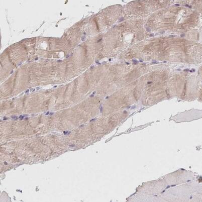 Immunohistochemistry-Paraffin: LRRC23 Antibody [NBP1-88962] -Staining of human skeletal muscle shows weak cytoplasmic positivity in myocytes.