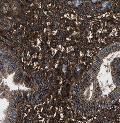 Immunohistochemistry-Paraffin: B7-H3/CD276 Antibody [NBP1-88966] - Staining of human endometrium shows strong membranous positivity in glandular cells.