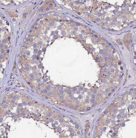 Immunohistochemistry-Paraffin USPL1 Antibody - BSA Free