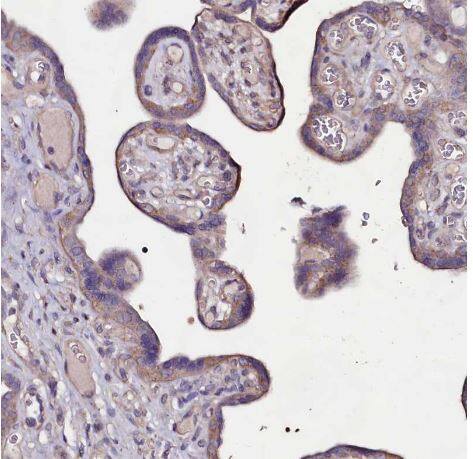 Immunohistochemistry-Paraffin USPL1 Antibody - BSA Free