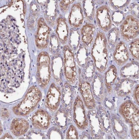 Immunohistochemistry-Paraffin USPL1 Antibody - BSA Free