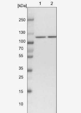 Western Blot: SART1 Antibody [NBP1-89023] -Lane 1: NIH-3T3 cell lysate (Mouse embryonic fibroblast cells)_br/_Lane 2: NBT-II cell lysate (Rat Wistar bladder tumour cells)
