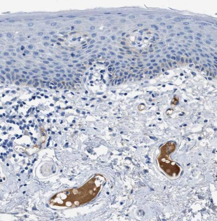 Immunohistochemistry-Paraffin Apolipoprotein L1 Antibody - BSA Free