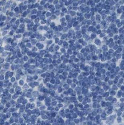 Staining of human tonsil shows no positivity in non-germinal center cells as expected.