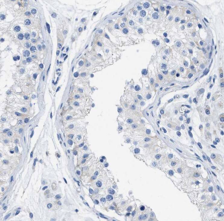  Staining of human testis shows negative cytoplasmic positivity in cells in seminiferous ducts as expected.