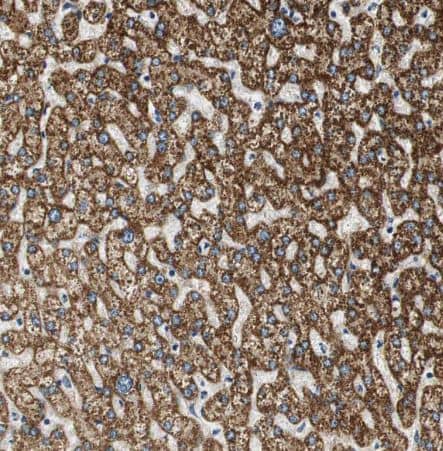 Immunohistochemistry-Paraffin: ALDH4A1 Antibody [NBP1-89149] - Staining of human liver shows strong granular cytoplasmic positivity in hepatocytes.