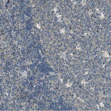 Immunohistochemistry-Paraffin: ALDH4A1 Antibody [NBP1-89149] - Staining of human lymph node shows no positivity in lymphoid cells as expected.