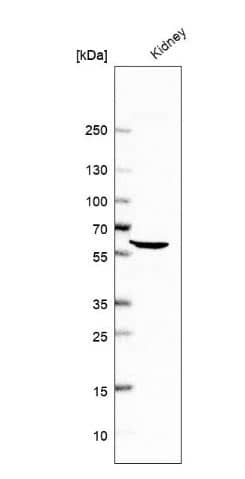 Western Blot: ALDH4A1 Antibody [NBP1-89149] -Analysis in human kidney tissue.