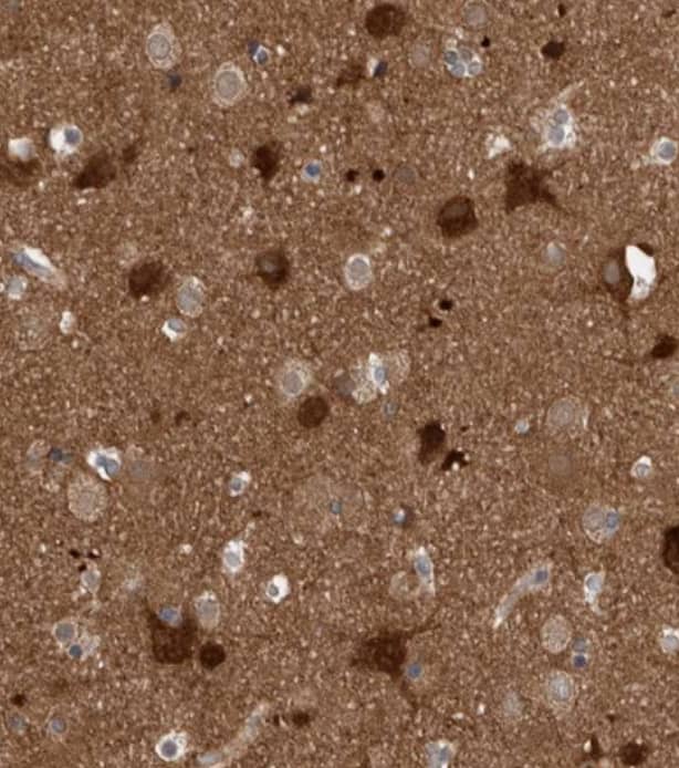 Staining of human cerebral cortex shows strong granular cytoplasmic positivity in neurons.