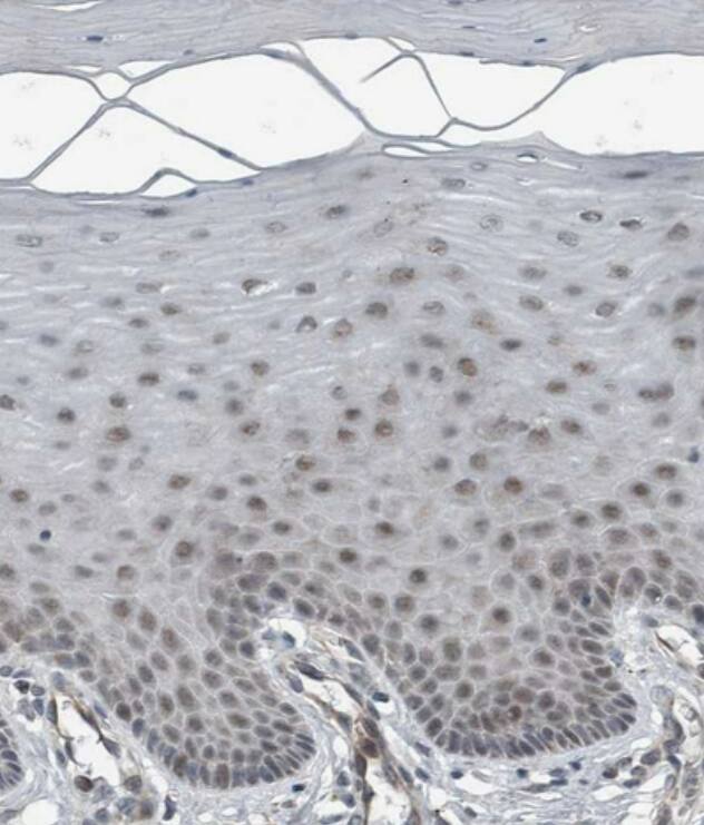 Staining of human cervix, uterine shows no positivity in squamous epithelial cells as expected.