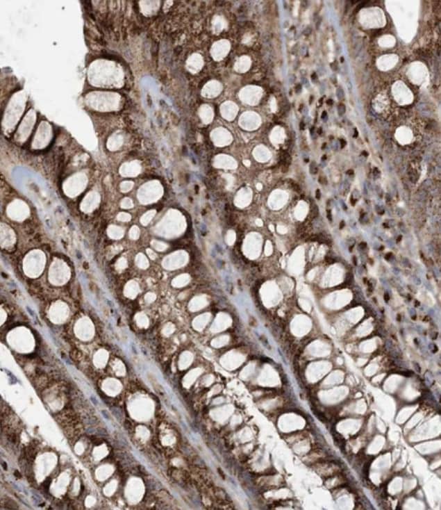 Immunohistochemistry-Paraffin TRAF3IP2 Antibody - BSA Free