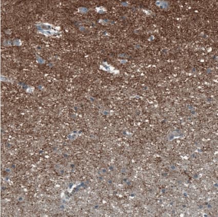 Immunohistochemistry-Paraffin SCD5 Antibody - BSA Free