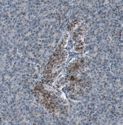 Immunohistochemistry-Paraffin SCD5 Antibody - BSA Free