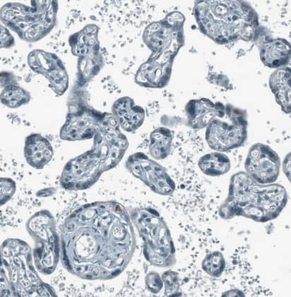 Immunohistochemistry-Paraffin: SCD5 Antibody [NBP1-89274] -Staining of human placenta shows no positivity in trophoblastic cells as expected.
