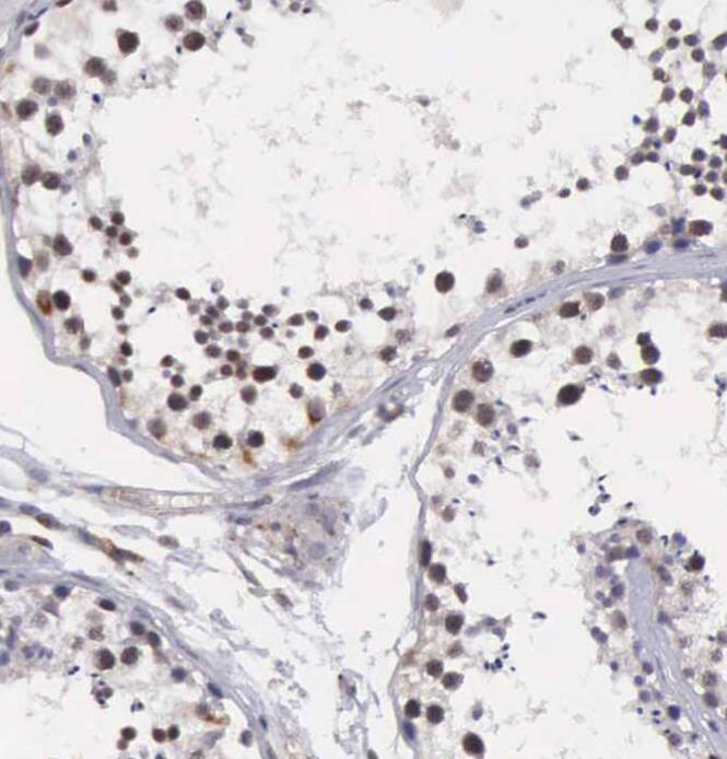 Immunohistochemistry-Paraffin MORC2 Antibody - BSA Free