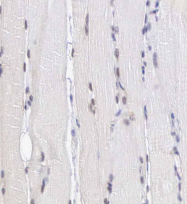 Immunohistochemistry-Paraffin MORC2 Antibody - BSA Free