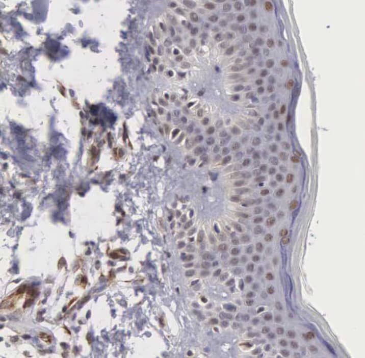 Immunohistochemistry-Paraffin MORC2 Antibody - BSA Free