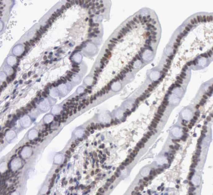 Immunohistochemistry-Paraffin MORC2 Antibody - BSA Free