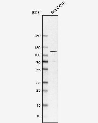 Western Blot: AARS2 Antibody [NBP1-89323] -Analysis in human cell line SCLC-21H.