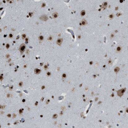 Immunohistochemistry-Paraffin: ZNF207 Antibody [NBP1-89550] -Staining of human cerebral cortex shows strong nuclear positivity in neurons.