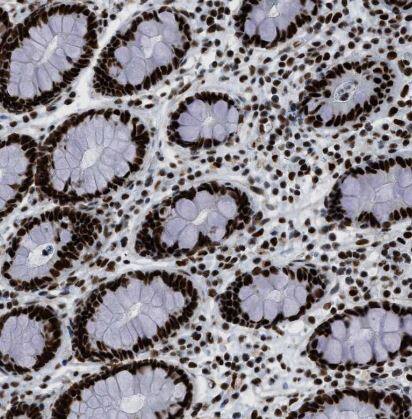 Immunohistochemistry-Paraffin: ZNF207 Antibody [NBP1-89550] -Staining of human colon shows strong nuclear positivity in glandular cells.