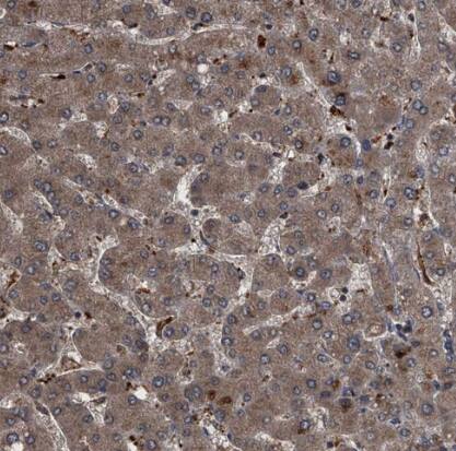 Immunohistochemistry-Paraffin: Sin1/MAPKAP1 Antibody [NBP1-89568] - Staining of human liver shows moderate cytoplasmic positivity in hepatocytes.