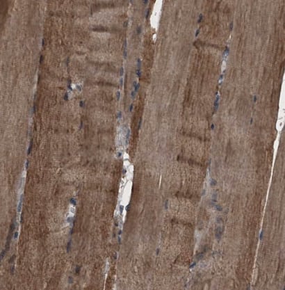 Immunohistochemistry-Paraffin: Sin1/MAPKAP1 Antibody [NBP1-89568] -Staining of human skeletal muscle shows strong cytoplasmic positivity in myocytes.