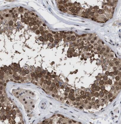 Immunohistochemistry-Paraffin: RENT1/UPF1/hUPF1 Antibody [NBP1-89641] - Staining of human testis shows strong cytoplasmic positivity in cells in seminiferous ducts.