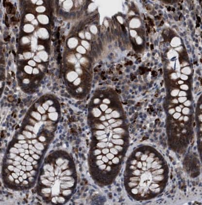 Immunohistochemistry-Paraffin: RENT1/UPF1/hUPF1 Antibody [NBP1-89641] - Staining of human colon shows strong cytoplasmic positivity in glandular cells.