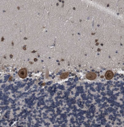 Immunohistochemistry-Paraffin: RENT1/UPF1/hUPF1 Antibody [NBP1-89641] - Staining of human cerebellum shows strong cytoplasmic and nuclear positivity in Purkinje cells.