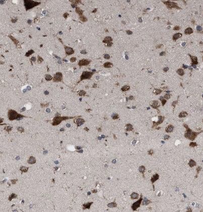 Immunohistochemistry-Paraffin: RENT1/UPF1/hUPF1 Antibody [NBP1-89641] - Staining of human cerebral cortex shows strong cytoplasmic positivity in neurons.