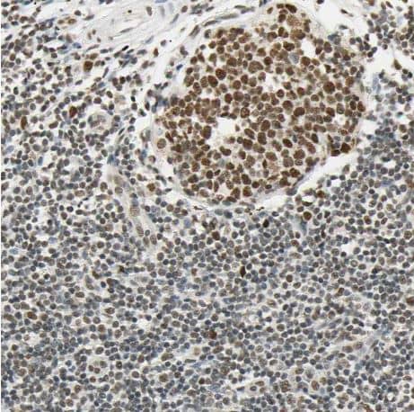 Immunohistochemistry-Paraffin: SMARCA5/SNF2H Antibody [NBP1-89692] -Staining of human tonsil shows strong nuclear positivity in germinal and non-germinal center cells 