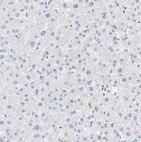 Immunohistochemistry-Paraffin: SMARCA5/SNF2H Antibody [NBP1-89692] -Staining of human liver shows no positivity in hepatocytes as expected.