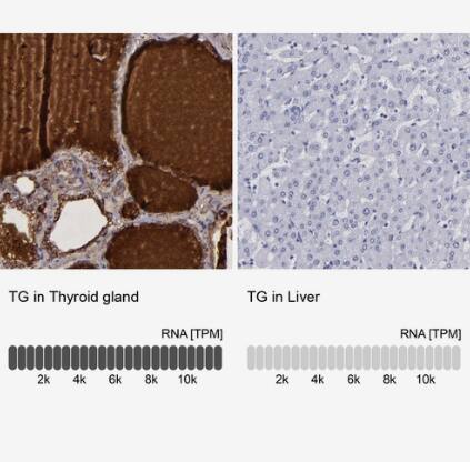 Immunohistochemistry-Paraffin: Thyroglobulin Antibody [NBP1-90200] -Analysis in human thyroid gland and liver tissues using NBP1-90200 antibody. Corresponding TG RNA-seq data are presented for the same tissues.