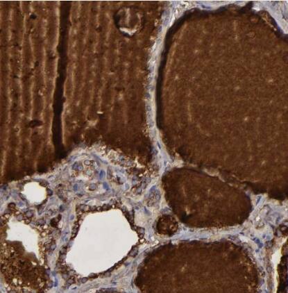 <b>Orthogonal Strategies Validation. </b>Immunohistochemistry-Paraffin: Thyroglobulin Antibody [NBP1-90200] - Staining of human thyroid gland shows strong positivity in plasma.