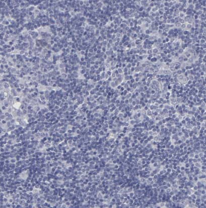 Immunohistochemistry-Paraffin: Thyroglobulin Antibody [NBP1-90200] - Staining of human lymph node shows no positivity in non-germinal center cells as expected.