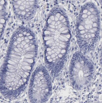Immunohistochemistry-Paraffin: Thyroglobulin Antibody [NBP1-90200] -Staining of human rectum shows no positivity in glandular cells as expected.